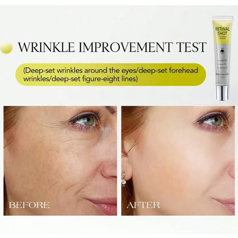 Retinal %0,1 Yoğun Bakım Panth - The Ordinary Serum Hyaluronic Acid incelemesi ve fiyatı