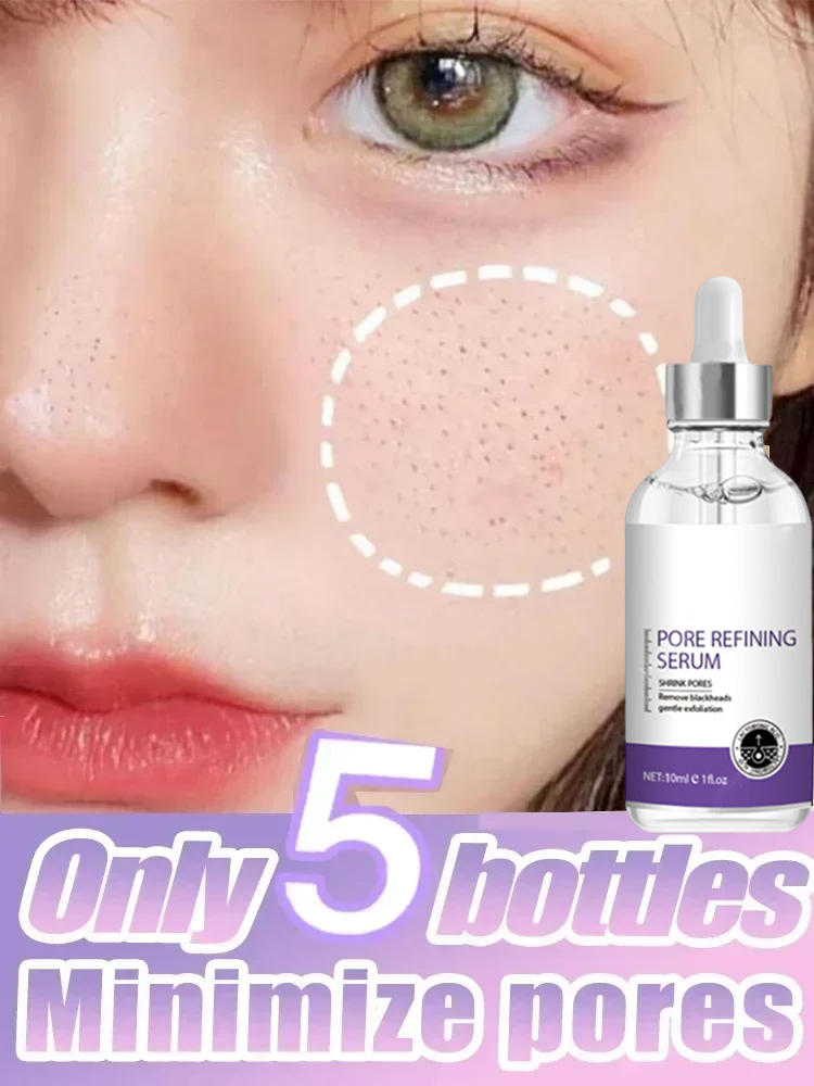 3. Cilt Dokusu |   Retinol ve  - The Ordinary Serum Hyaluronic Acid incelemesi ve fiyatı